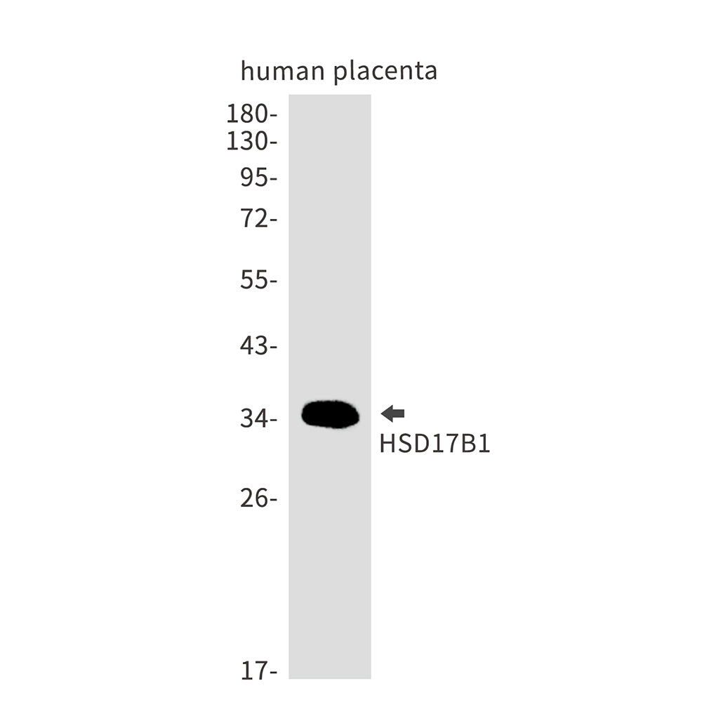 Anti-HSD17B1 Rabbit Monoclonal Antibody