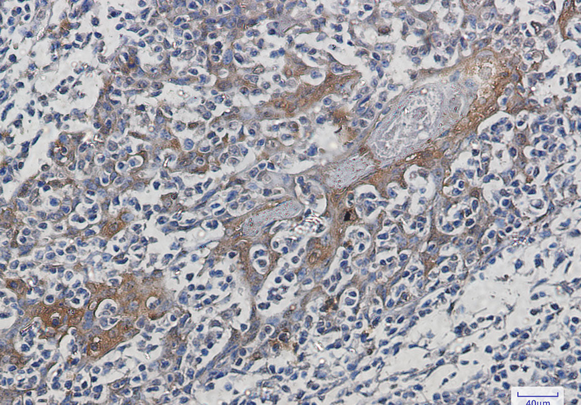 Anti-Hsp70 Rabbit Monoclonal Antibody