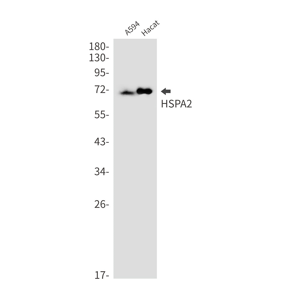 Anti-HspA2 Rabbit Monoclonal Antibody