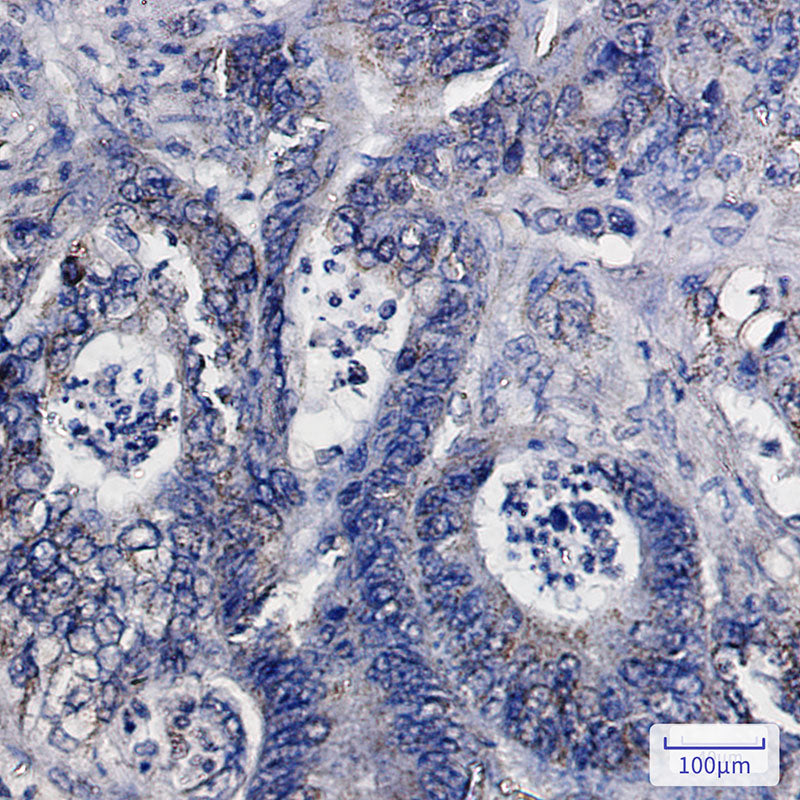 Anti-IDH2 Rabbit Monoclonal Antibody