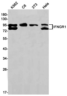 Anti-Interferon gamma Receptor 1 Rabbit Monoclonal Antibody