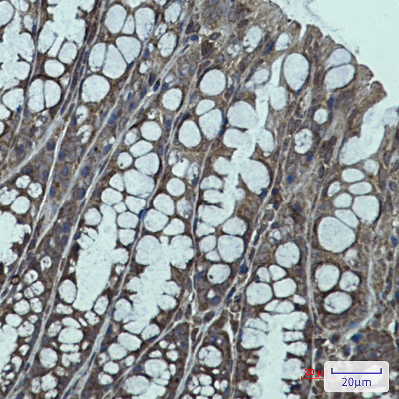 Anti-IGF2BP1 Rabbit Monoclonal Antibody