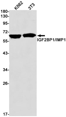 Anti-IGF2BP1 Rabbit Monoclonal Antibody