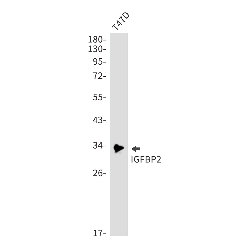 Anti-IGFBP2 Rabbit Monoclonal Antibody