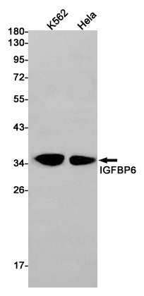 Anti-IGFBP6 Rabbit Monoclonal Antibody