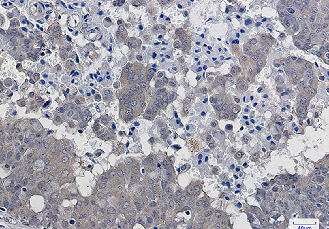 Anti-IKB beta Rabbit Monoclonal Antibody