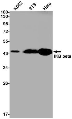 Anti-IKB beta Rabbit Monoclonal Antibody