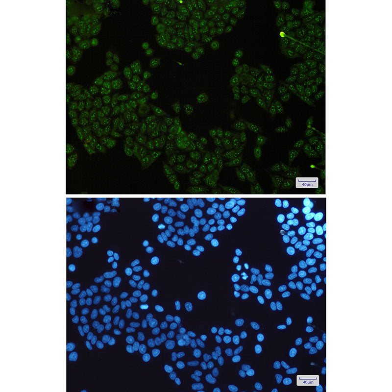 Anti-IKK gamma Rabbit Monoclonal Antibody