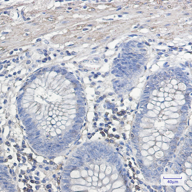 Anti-IL-11 Receptor alpha Rabbit Monoclonal Antibody