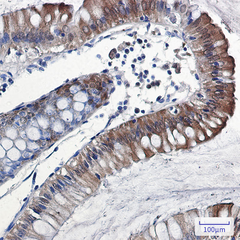 Anti-IL-18 Rabbit Monoclonal Antibody