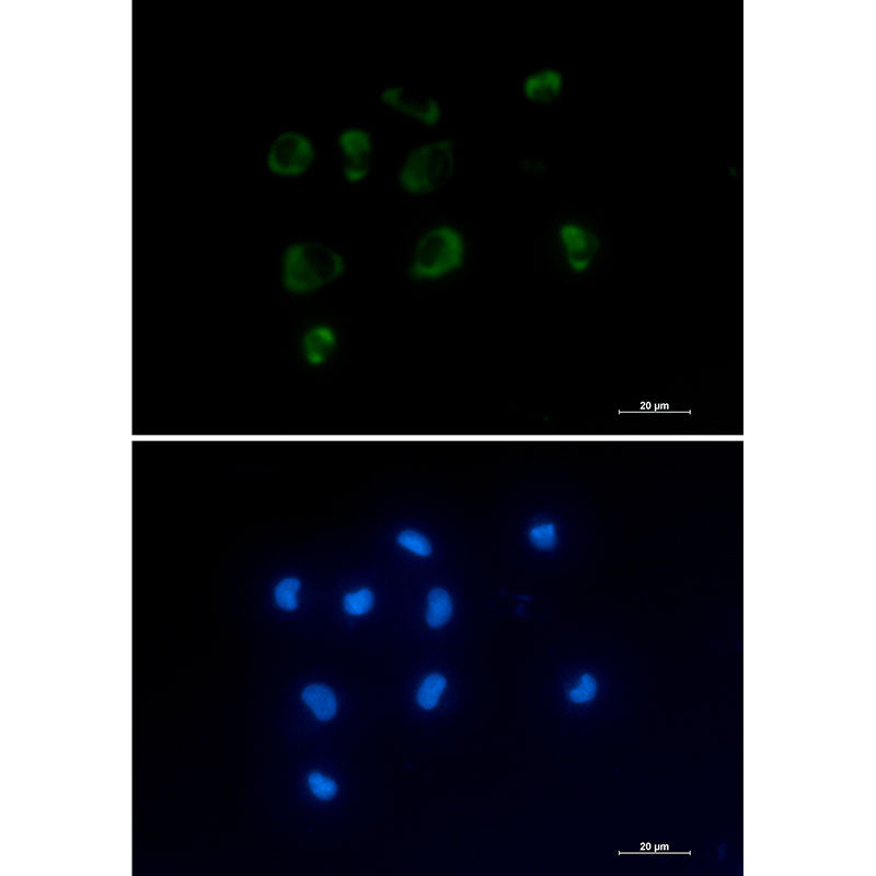 Anti-IL-1 Receptor Antagonist Protein Rabbit Monoclonal Antibody
