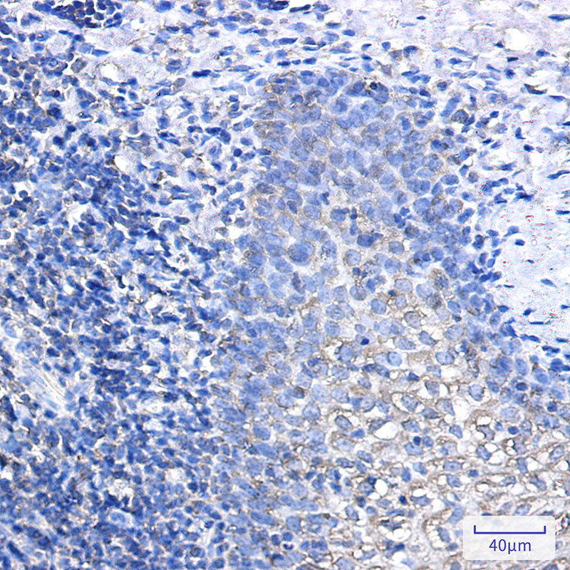 Anti-IL-1 Receptor Antagonist Protein Rabbit Monoclonal Antibody