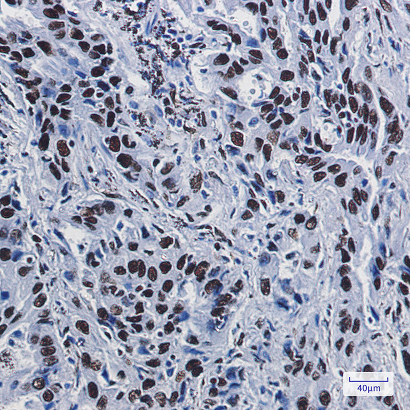 Anti-ILF3 Rabbit Monoclonal Antibody