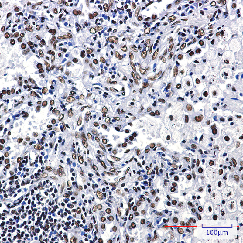 Anti-ILF3 Rabbit Monoclonal Antibody