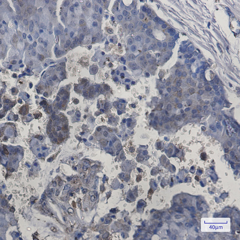 Anti-ITPA Rabbit Monoclonal Antibody