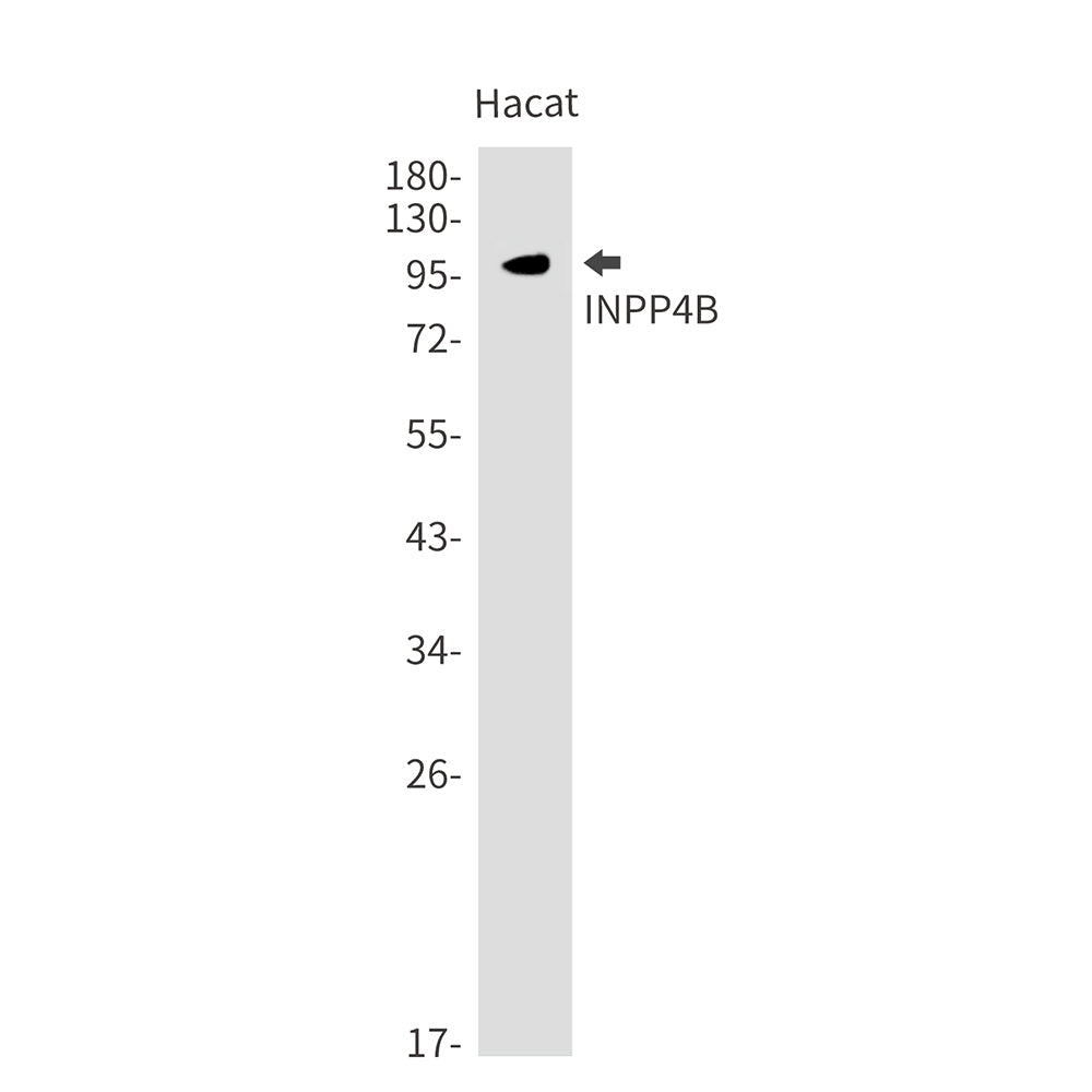 Anti-INPP4B Rabbit Monoclonal Antibody