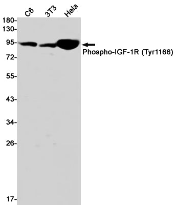 Anti-Phospho-IGF1 Receptor (Tyr1166) Rabbit Monoclonal Antibody