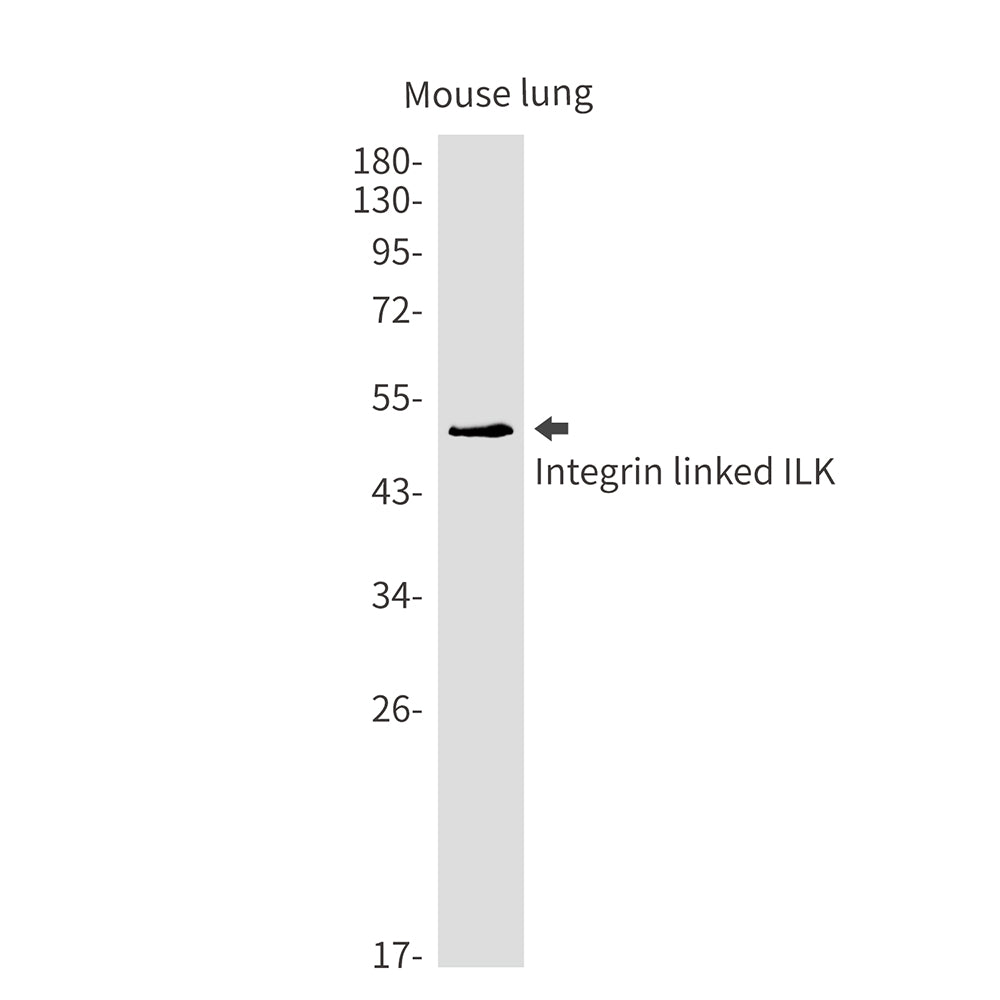 Anti-Integrin Linked ILK Rabbit Monoclonal Antibody