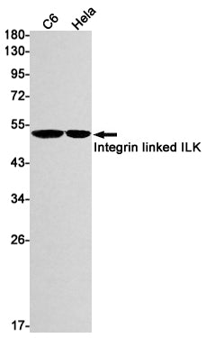 Anti-Integrin Linked ILK Rabbit Monoclonal Antibody