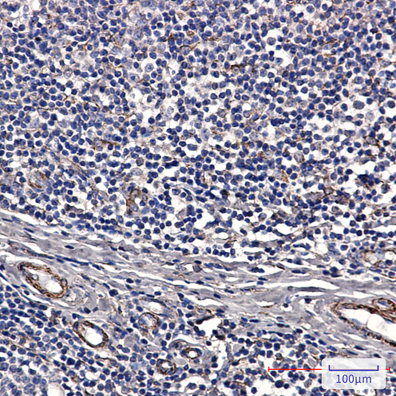 Anti-IRAK4 Rabbit Monoclonal Antibody