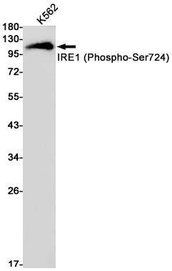 Anti-Phospho-IRE1 (Ser724) Rabbit Monoclonal Antibody