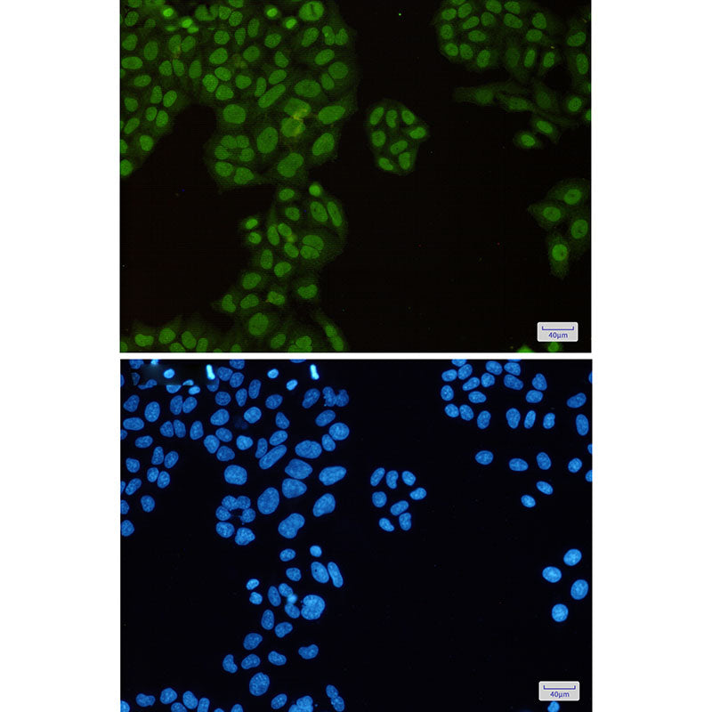 Anti-KAP1 Rabbit Monoclonal Antibody