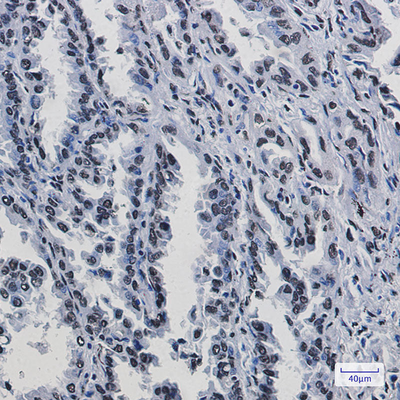 Anti-KAP1 Rabbit Monoclonal Antibody