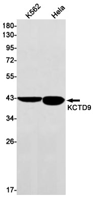 Anti-KCTD9 Rabbit Monoclonal Antibody