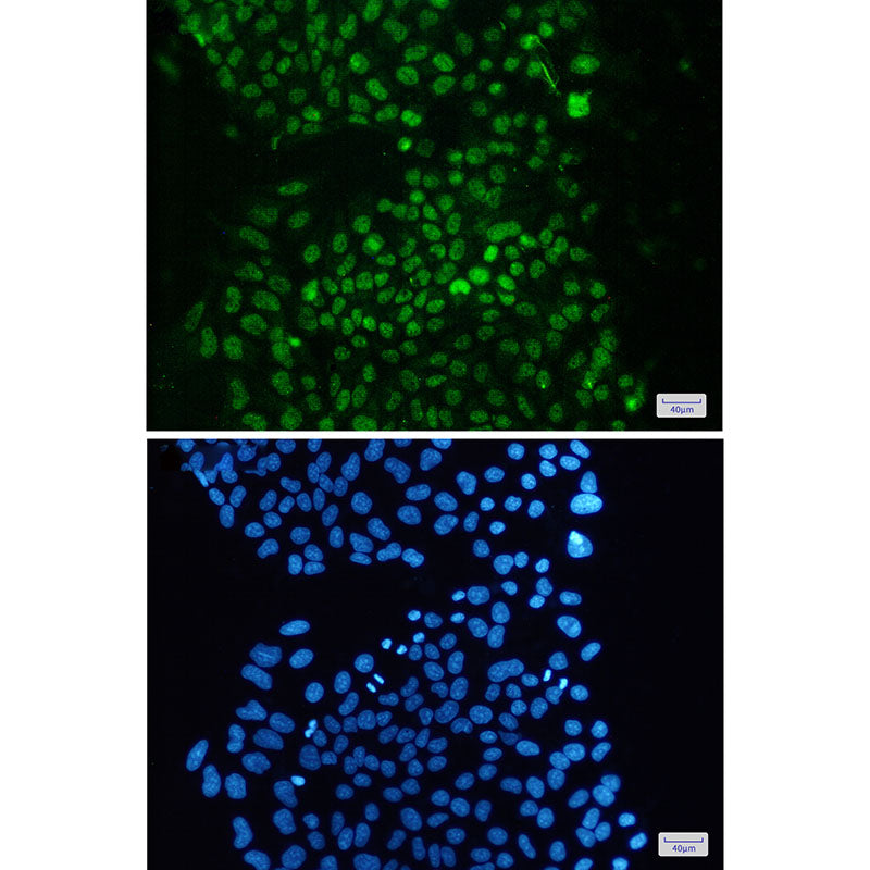 Anti-KDM1A Rabbit Monoclonal Antibody