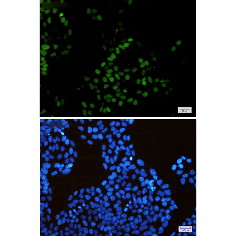Anti-KIFC1 Rabbit Monoclonal Antibody