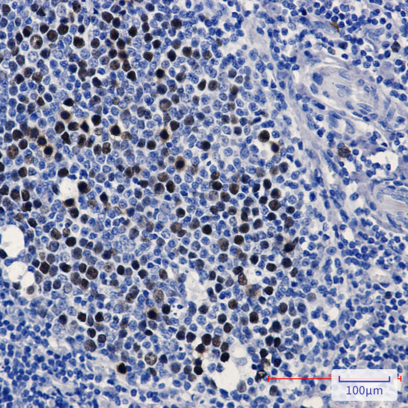 Anti-KIFC1 Rabbit Monoclonal Antibody