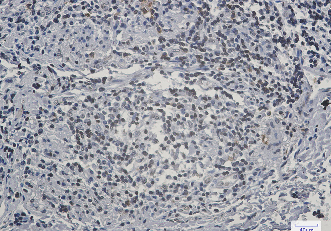 Anti-Lamin B Receptor Rabbit Monoclonal Antibody