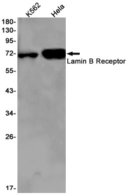 Anti-Lamin B Receptor Rabbit Monoclonal Antibody
