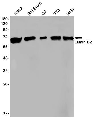 Anti-Lamin B2 Rabbit Monoclonal Antibody
