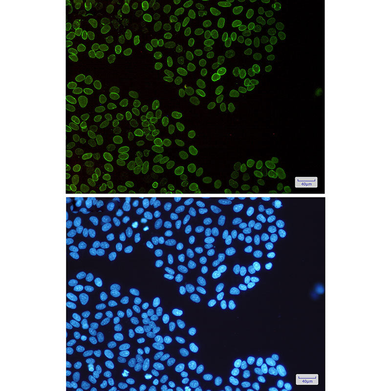 Anti-Lamin B2 Rabbit Monoclonal Antibody