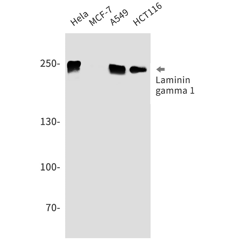 Anti-Laminin gamma 1 Rabbit Monoclonal Antibody