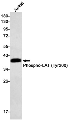 Anti-Phospho-LAT (Tyr200) Rabbit Monoclonal Antibody