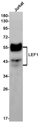Anti-LEF1 Rabbit Monoclonal Antibody