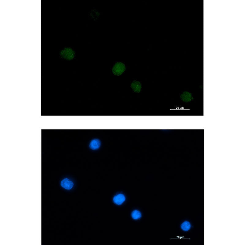 Anti-LGALS14 Rabbit Monoclonal Antibody