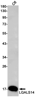 Anti-LGALS14 Rabbit Monoclonal Antibody