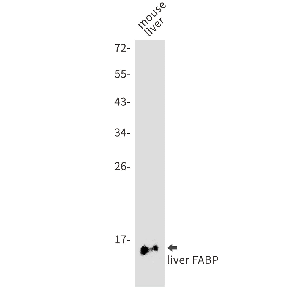 Anti-FABP1 Rabbit Monoclonal Antibody