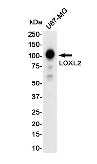 Anti-LOXL2 Rabbit Monoclonal Antibody