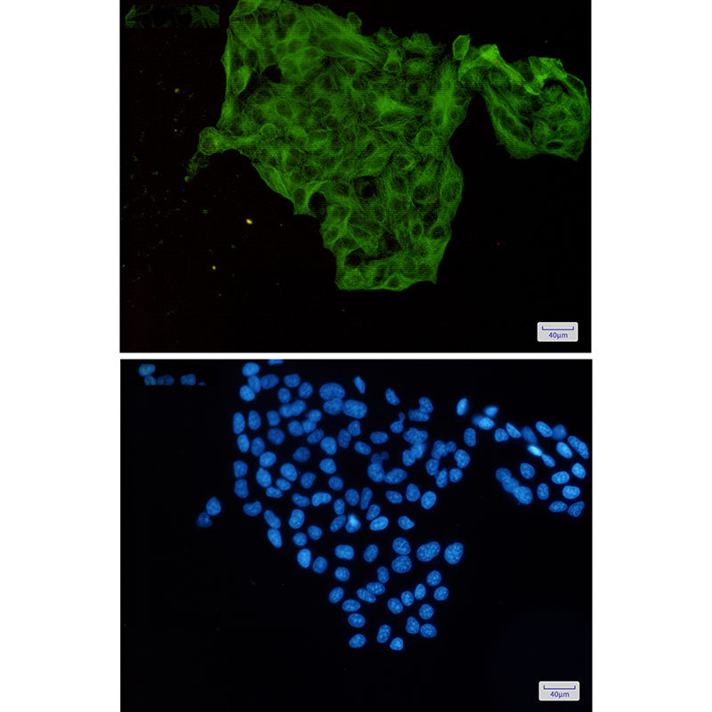 Anti-Lumican Rabbit Monoclonal Antibody