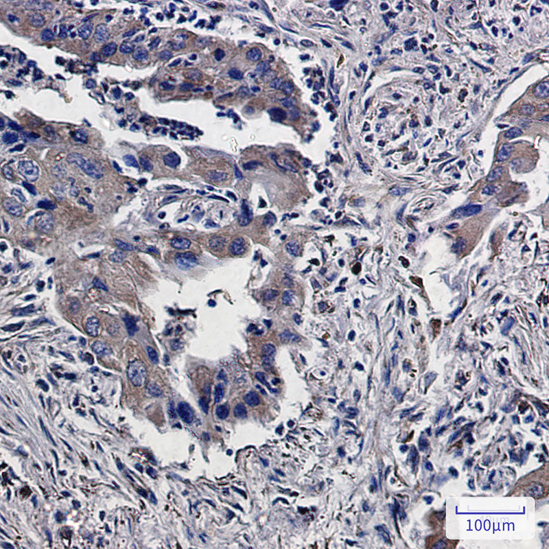Anti-Lumican Rabbit Monoclonal Antibody