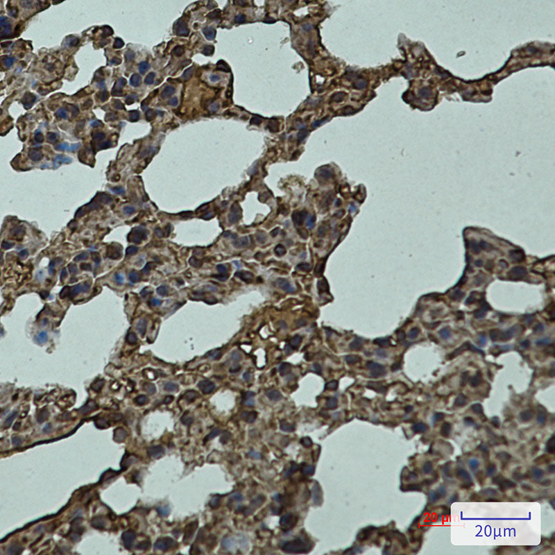 Anti-LYVE1 Rabbit Monoclonal Antibody