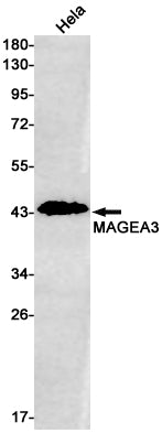 Anti-MAGEA3 Rabbit Monoclonal Antibody