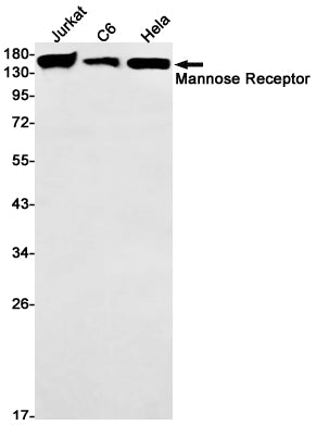 Anti-Mannose Receptor Rabbit Monoclonal Antibody
