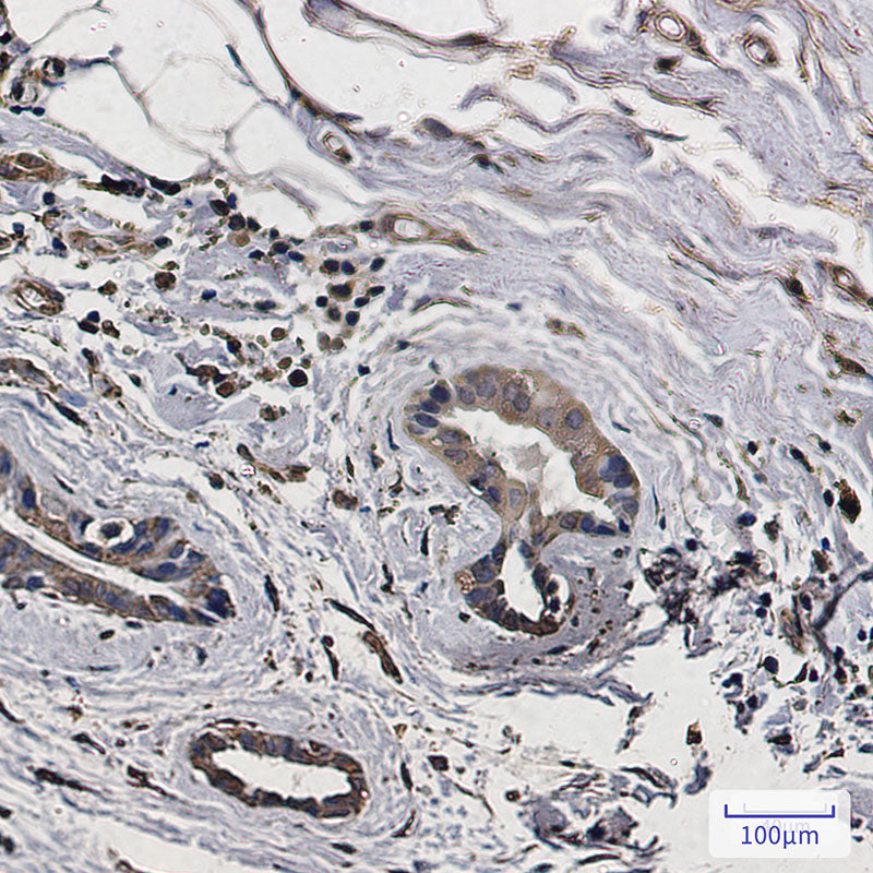 Anti-LC3A Rabbit Monoclonal Antibody