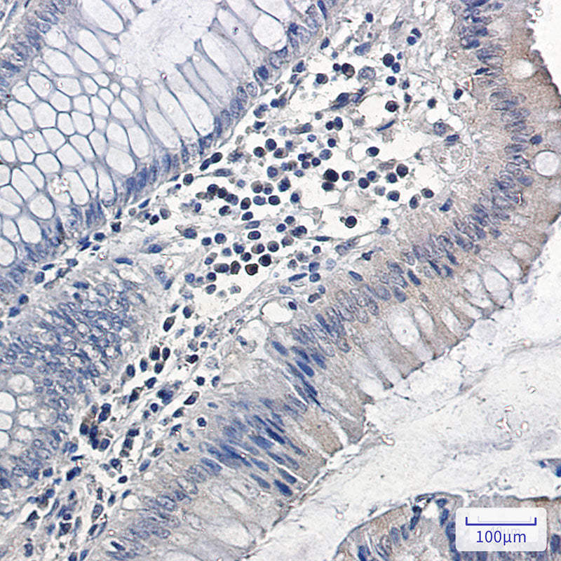Anti-MAPK6 Rabbit Monoclonal Antibody
