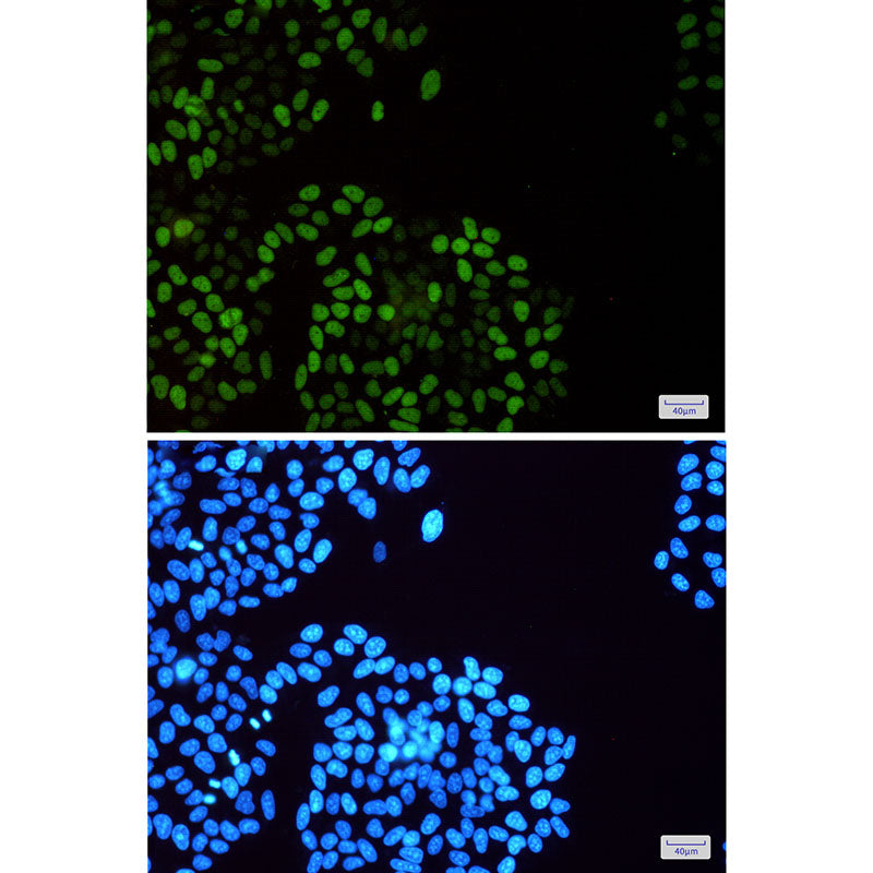 Anti-Phospho-MCM2 (Ser108) Rabbit Monoclonal Antibody
